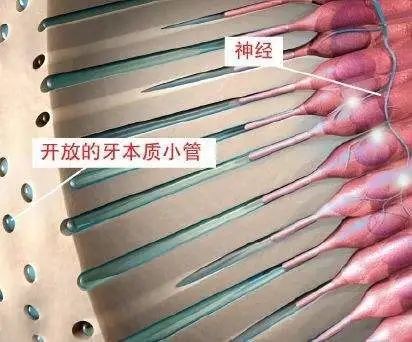 男童牙齿长在牙龈上,男童牙齿内壁长了一颗牙