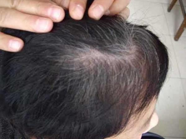 小孩子白头发父母如何正确引导,14岁小孩有白头发怎么办