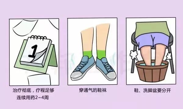 脚气，那是一种什么感觉？