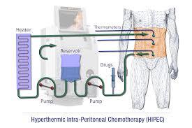 妇科癌症怎么预防和筛查,听专家讲肿瘤