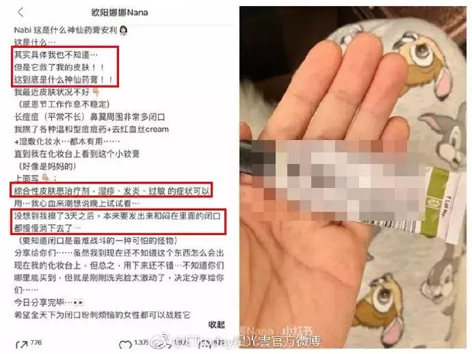 欧阳娜娜擦什么药膏好,欧阳娜娜安利祛疤膏