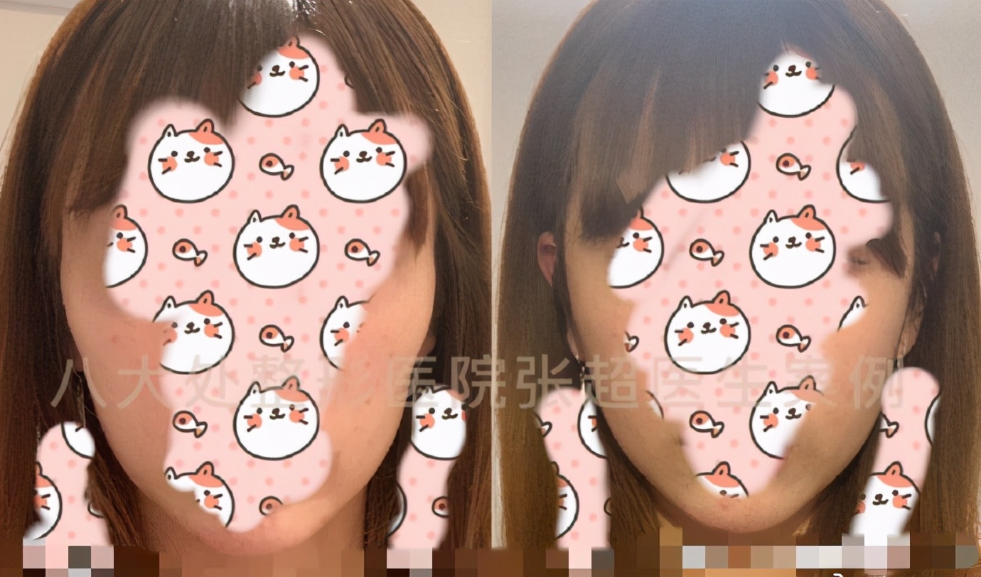 八大处张超抖音,八大处张超合集