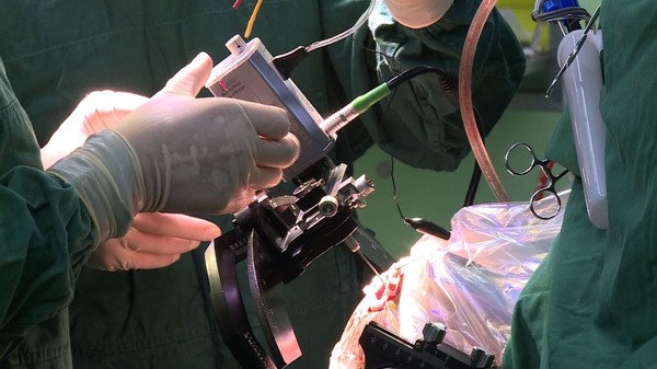 国外先进神经外科手术,神经外科手术真实案例