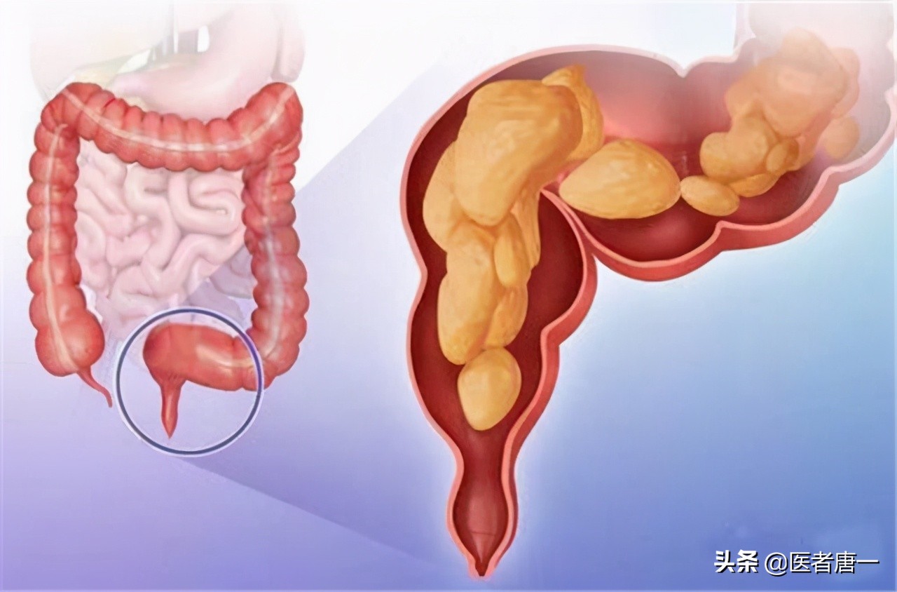 别不好意思做：提肛运动真的很养生，每天做几分钟，男女都受益
