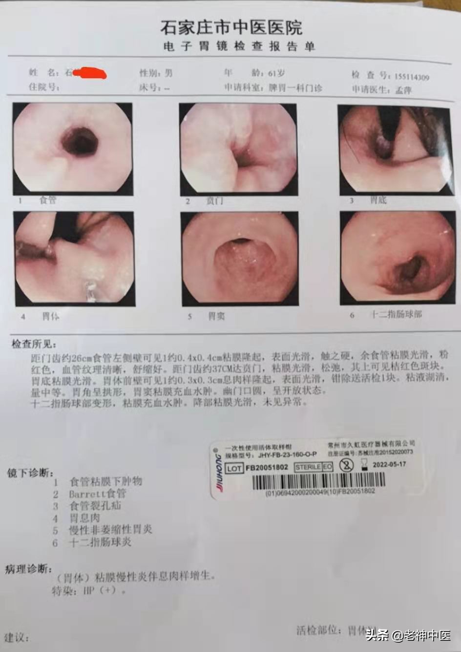 治疗幽门杆菌胃炎的药物有哪些,胃炎幽门螺杆菌感染怎么治疗