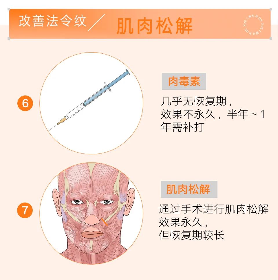法令纹怎么改善脸部衰老,改善法令纹按摩手法视频