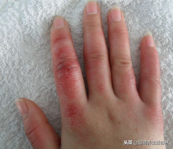 古代防寒神器,古代必备十大神药