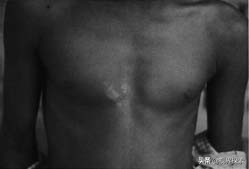 你的胎记在哪个位置看出你的含义,你的胎记在哪里找