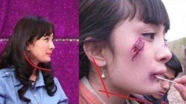 那些一刀切削骨的明星还好吗？后遗症一大堆，小方脸成最大赢家