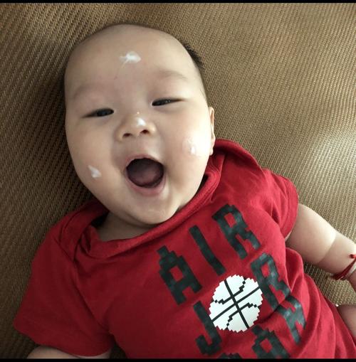 宝宝湿疹反反复复该怎么办,为啥宝宝湿疹反反复复的