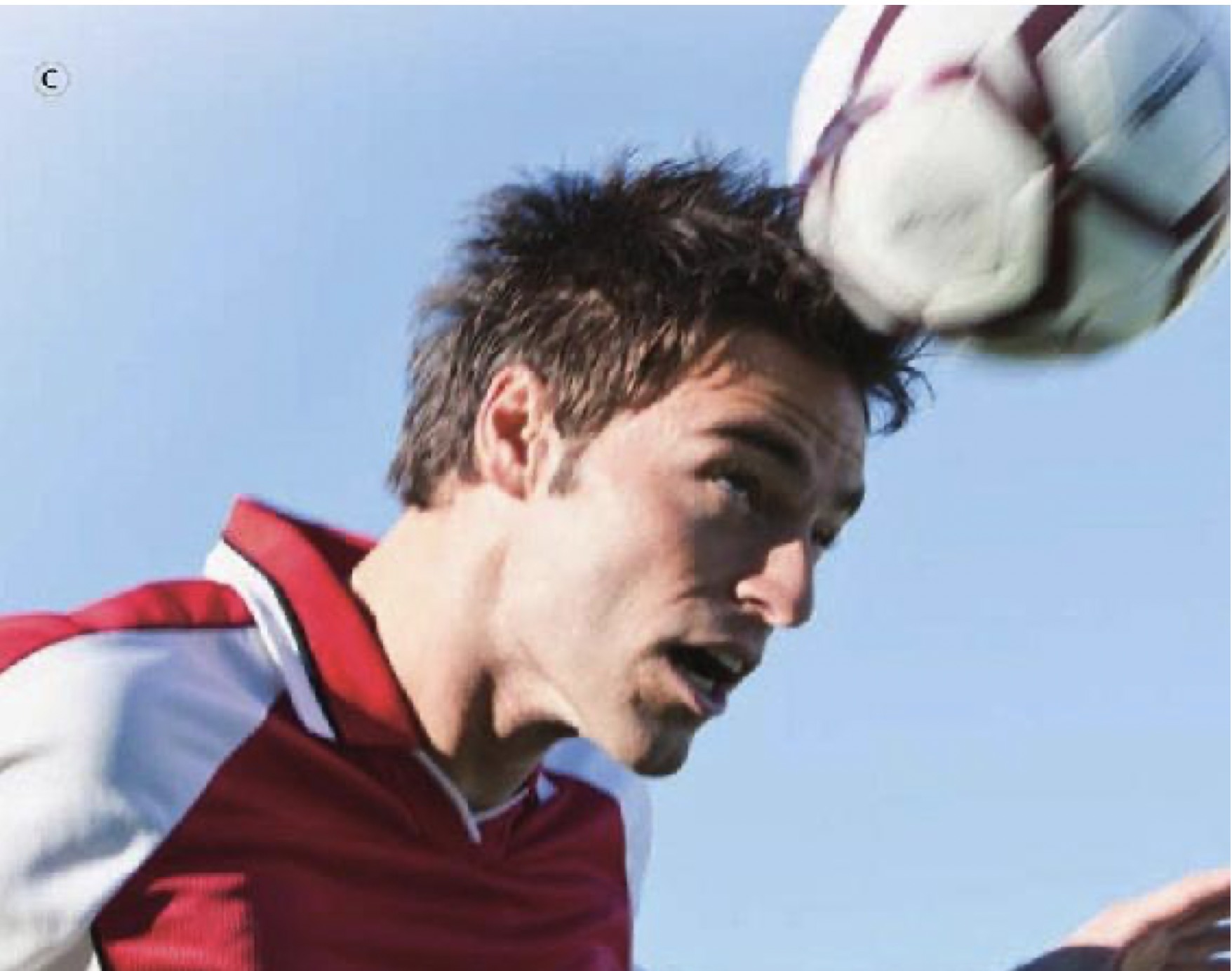 用头顶使劲撞墙会造成脑震荡么,自己用头撞墙会有脑震荡么