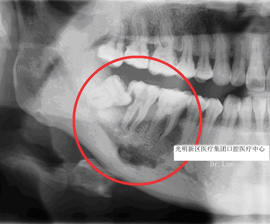 牙科诊所里你不知道的事,口腔医生提醒