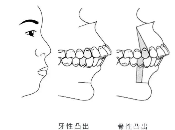 谁说圆脸女生不惊艳,谁说脸圆的女孩不好看