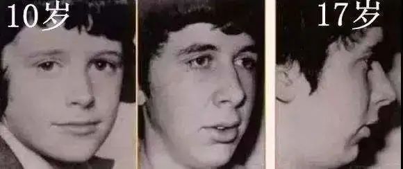 面部可以看出内脏疾病,脸部有哪些问题就得注意了