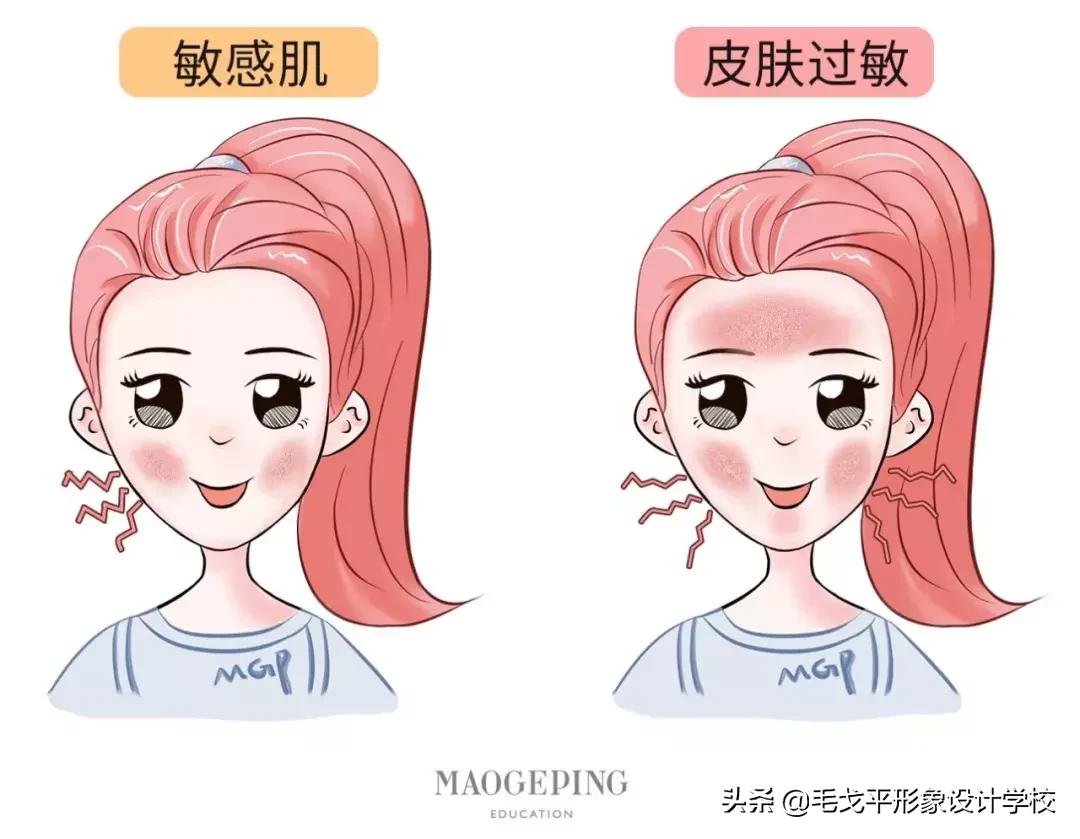 泛红敏感痘肌修复,敏感肌肤泛红修复痘印方法