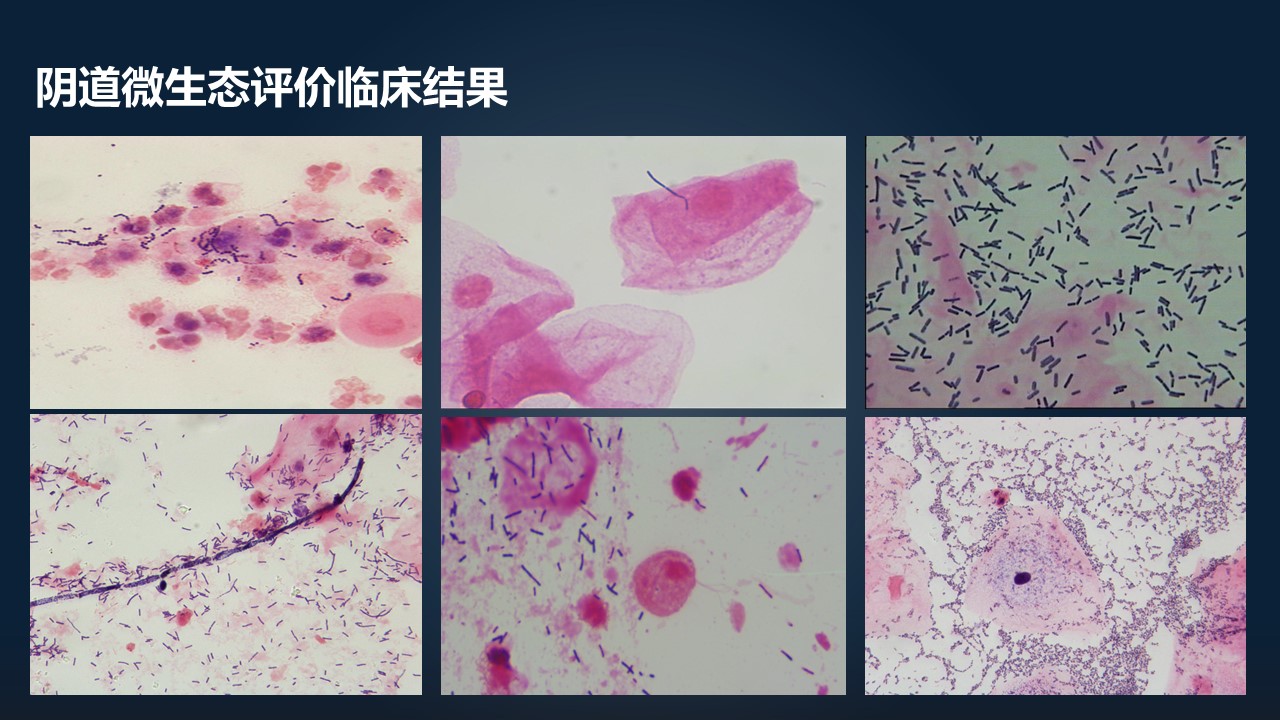 肖冰冰的小视频,肖冰冰讲的12生肖