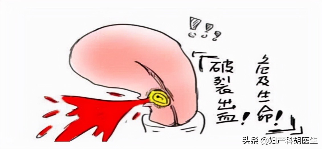 人工流产真实例子,人工流产的悲催案例