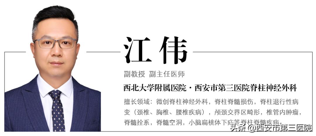 【医者解读】揭开“骶管囊肿”之神秘面纱，查出骶管囊肿都需要治疗吗？（手术病例+文献回顾）