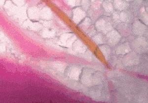 当一只蚊子吸了吸血鬼的血,当一只蚊子吸了德古拉