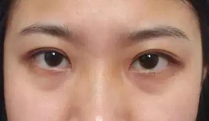 眼霜如何挑选先来看看这篇干货,眼霜排名十大公认好用的眼霜测评