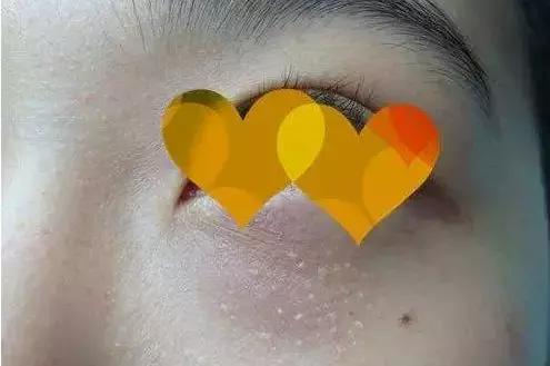 有哪些眼霜不能买,推荐几款比较好用的眼霜