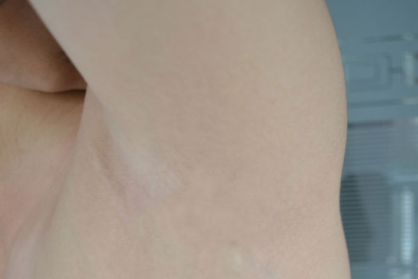 剃腋毛的正确方法,腋毛到底能不能剃