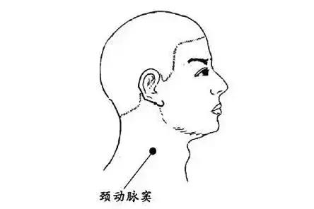 新郎亲吻新娘致死新闻,新郎亲吻新娘导致死亡