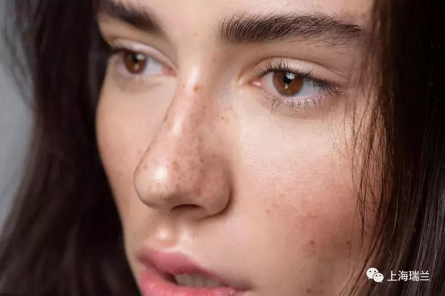 百“斑”刁难，“秒”速解忧