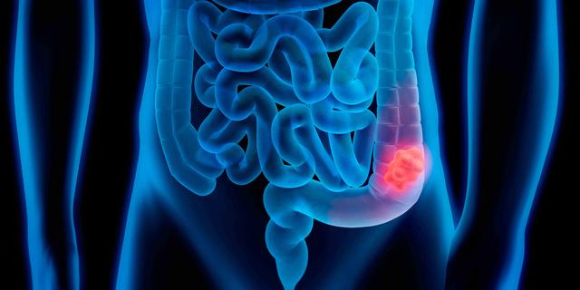 不胀气老是放屁怎么回事,不放屁代表肠胀气结束了吗