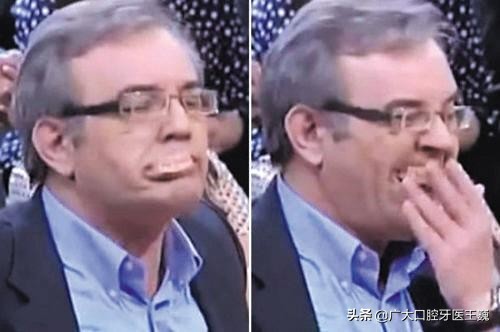 老人活动假牙戴上了牙齿疼,老人戴活动假牙总是掉怎么办