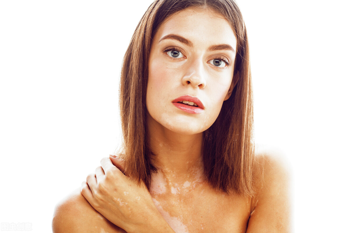 白癜风患者经常熬夜会加重病情吗,白癜风患者养狗会加重病情吗