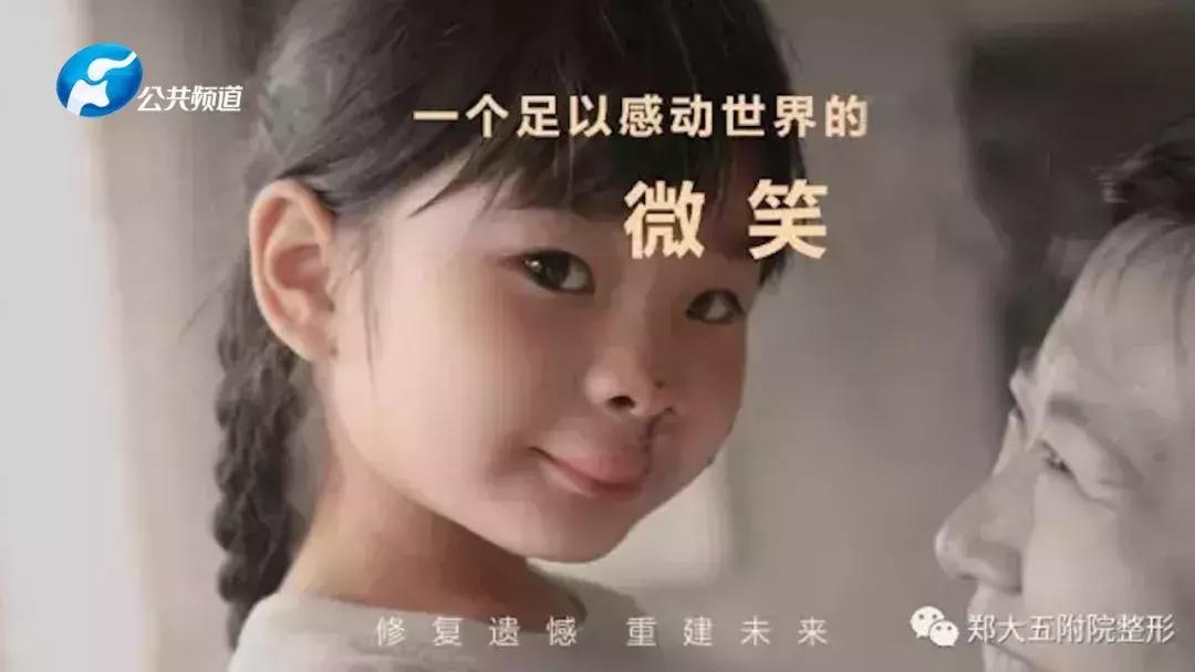 天然去雕饰真正的美,郑州中心医院整形美容外科怎么样