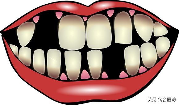 坏牙怎么办,补的牙坏了再补需要多少钱