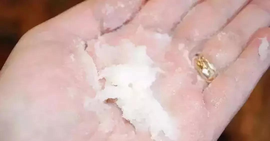 天气一冷手就干裂怎么办,天气一冷手皮肤起皱