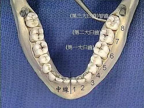 拔智齿疼还是智齿发炎疼,智齿疼可以拔智齿吗