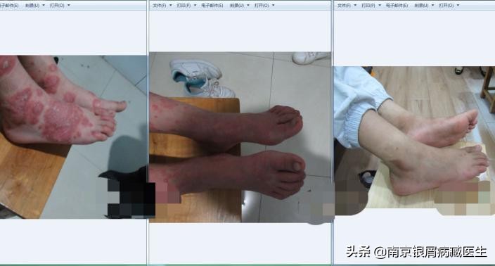 22岁女子喝奶茶送进icu,22岁女子喝奶茶被送到icu