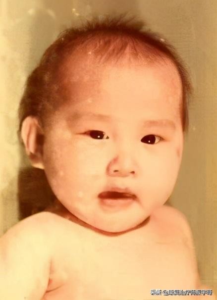 可怕的基因代谢病，一年奶粉钱足以吞噬一套房