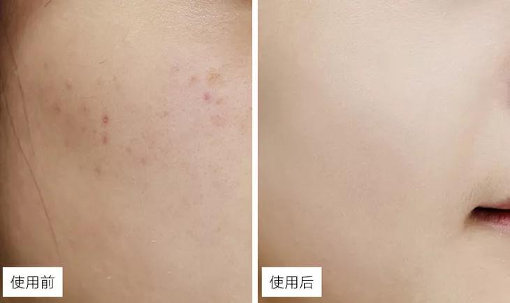 日本敏感皮肤面霜,日本人五合一面霜