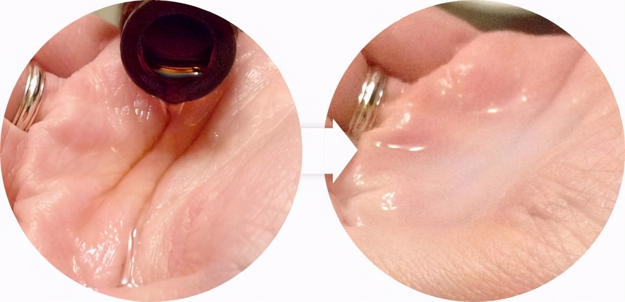 如何消除眼角皱纹和抬头纹的方法,消除川字纹和抬头纹最有效的方法