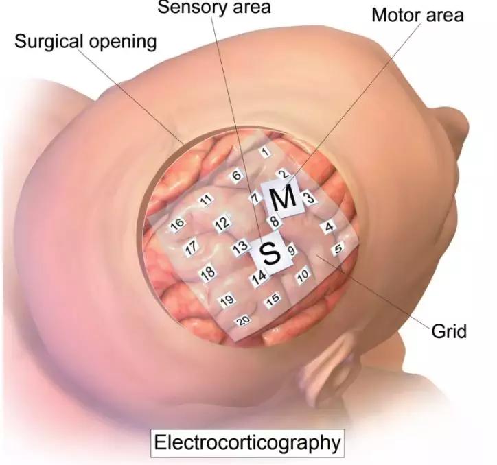马斯克说可以让人永生的技术,马斯克不做没必要的事