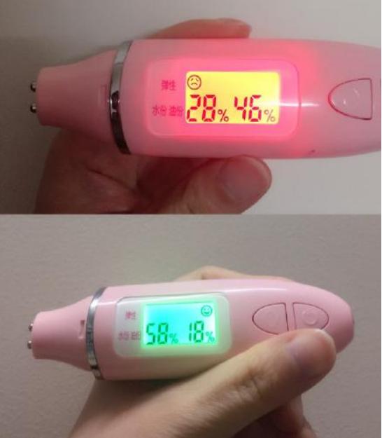 做美容的女人勇气可嘉,打了美容针的女人现在怎么样了