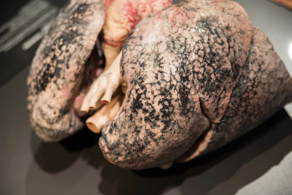 吸烟30年的肺戒烟后的变化,戒烟以后多久肺会恢复变白