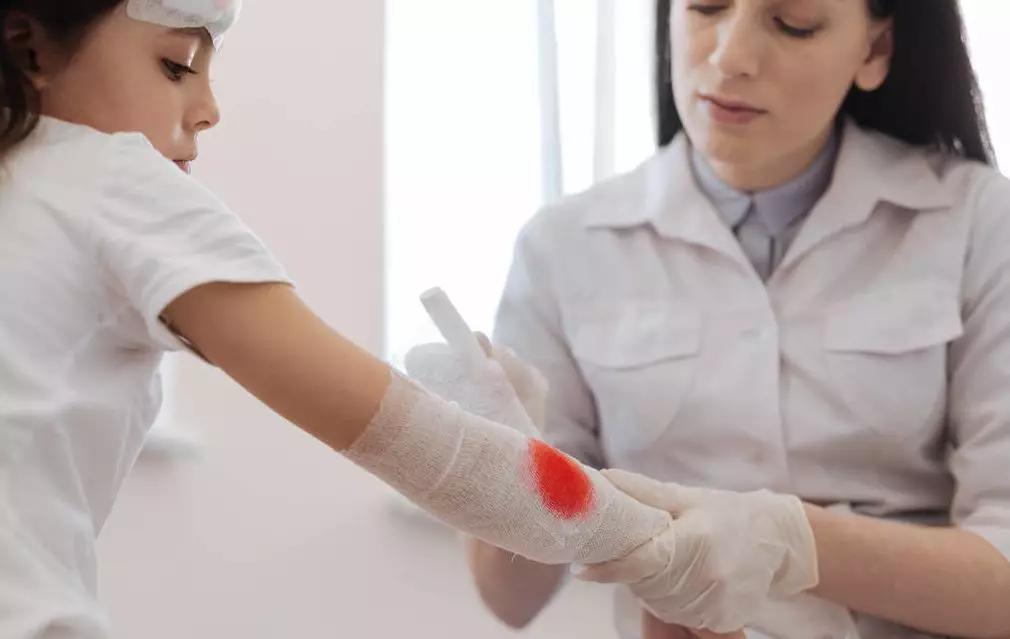 血管瘤破了结痂,宝宝血管瘤破溃结痂好了