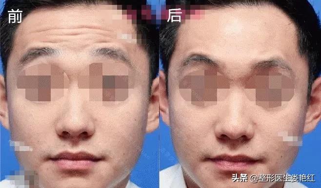 变美逆袭逆龄抗衰变美小妙招,逆龄抗衰手法一起开启变美之路