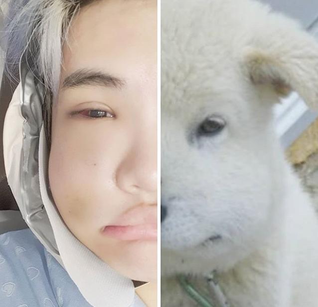 韩国明星男整容对比,韩国男明星整容疑似失败