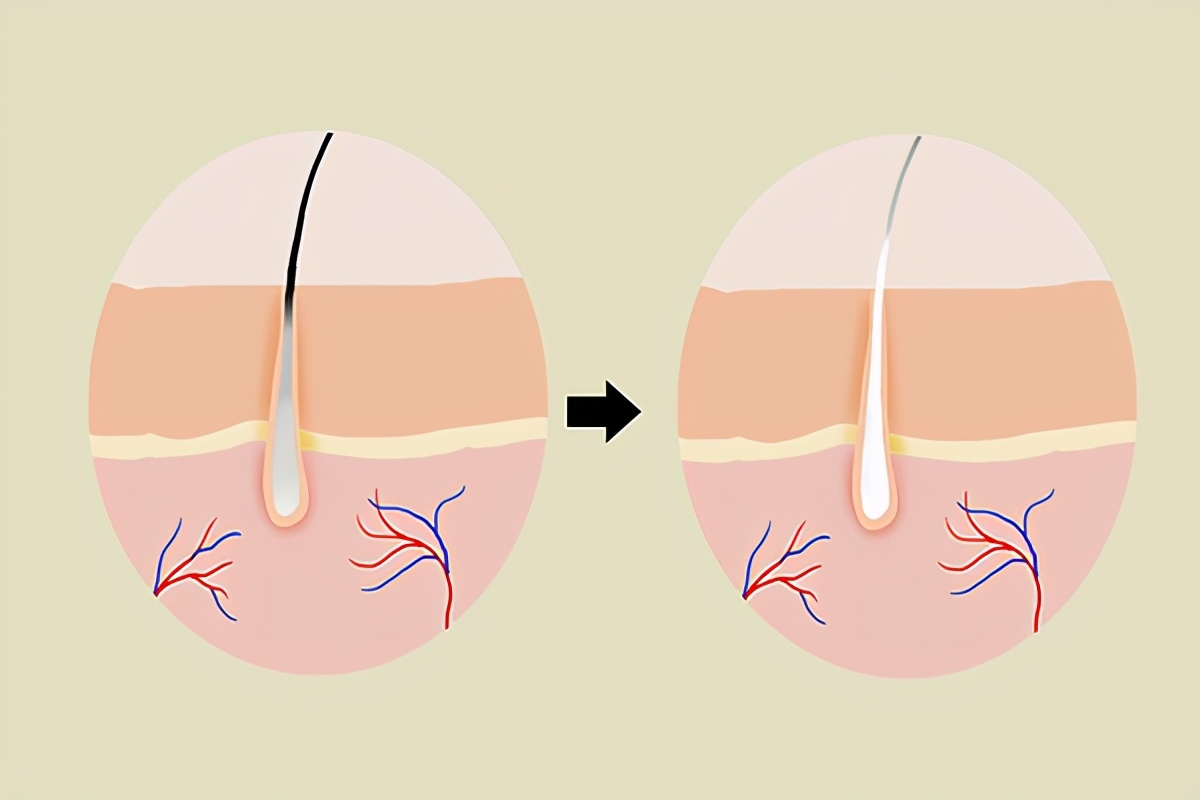 中医对两鬓白发的解读,两鬓长白发是什么原因中医