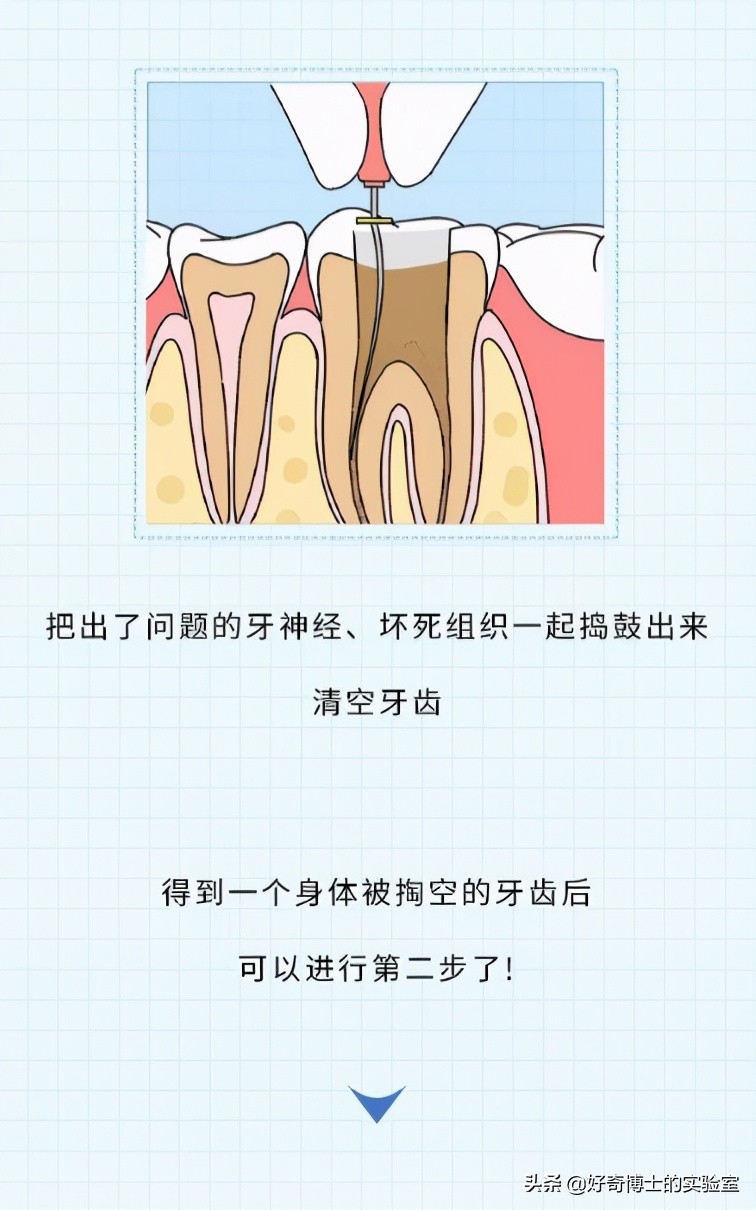 治牙到底有多恐怖,治牙有多痛苦