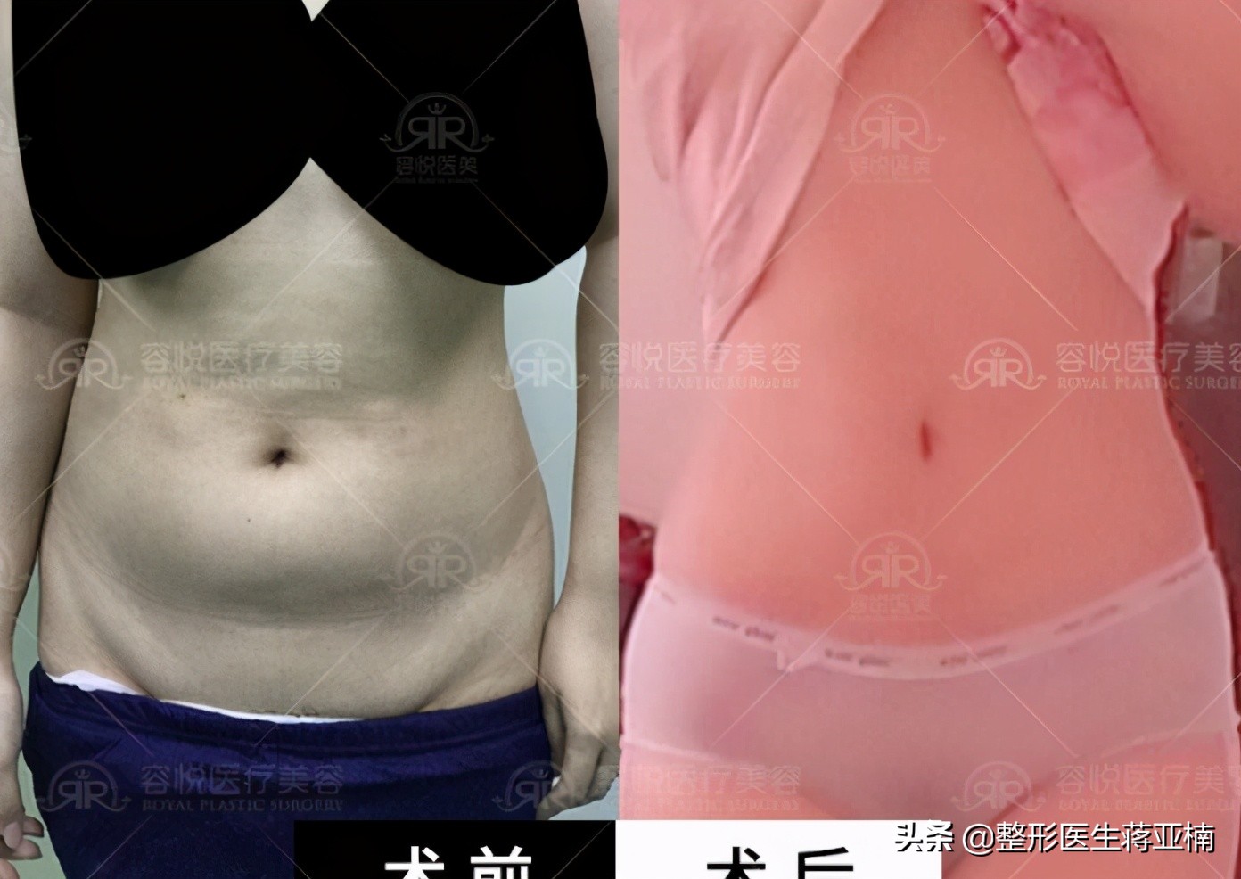 一次性说清,一次性说清一维到十维