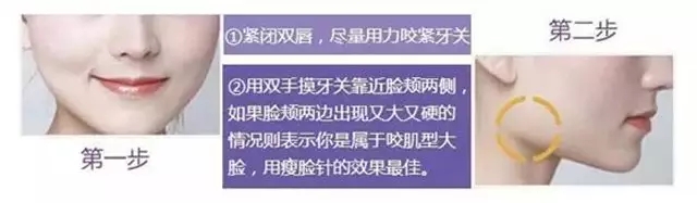 打瘦脸针后如何避免咬肌反弹,肉毒素瘦脸针怎么样避免碰到神经