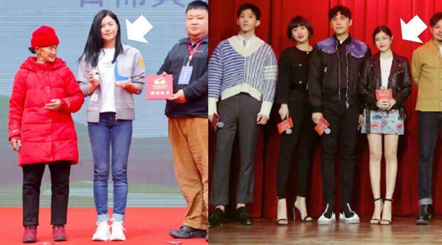 斜方肌太厚了好看吗,斜方肌太厚造成驼背背紧